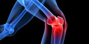 All You Need to Know About Knee Injury Workers Comp Settlement